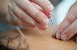 Professionel akupunktur behandling i Slagelse