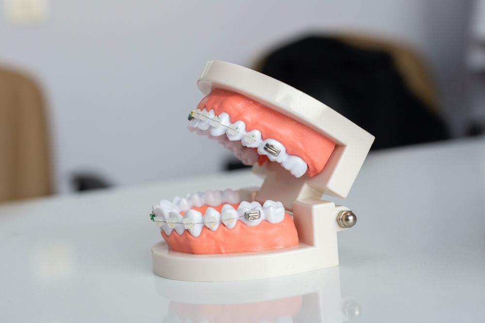 Få 7 års garanti på tandproteser fra den lokale tandklinik i Kolding