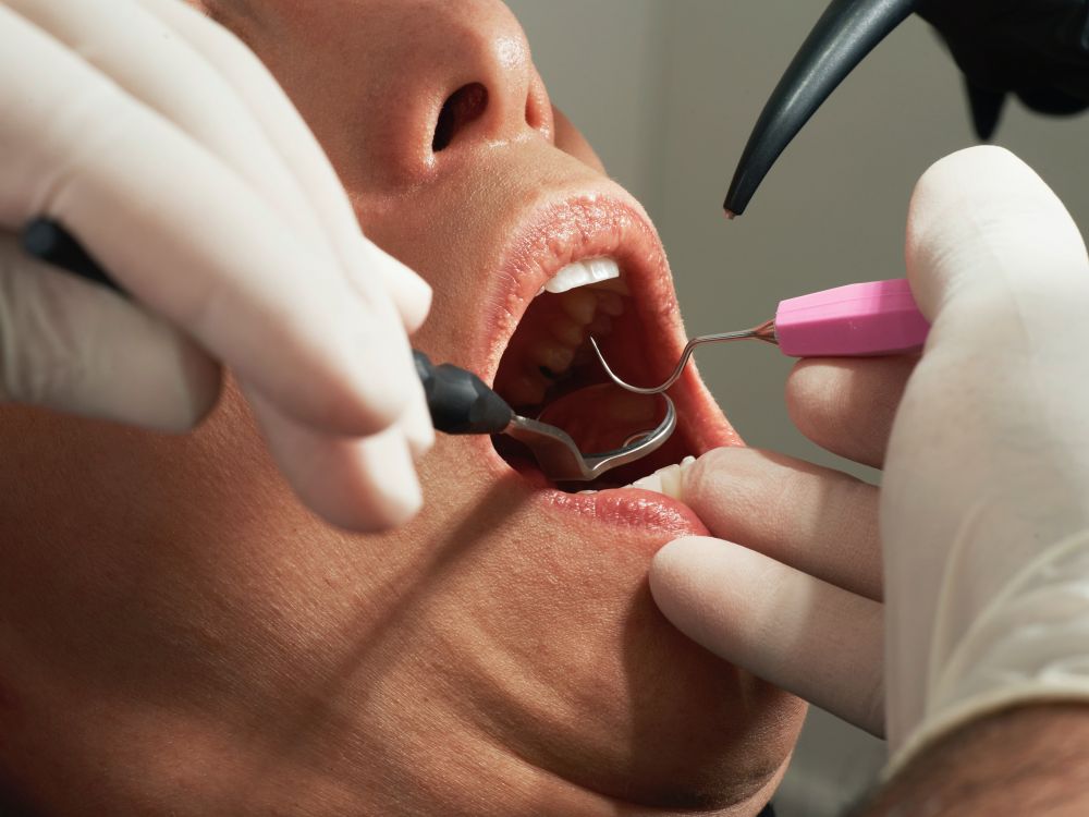 Få hjælp til dine tænder hos tandlæge i Søborg